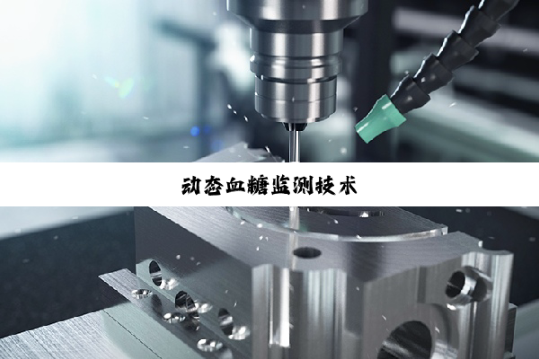 今日科普|动态血糖监测技术
